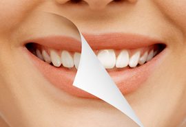 درمان دندان های بدشکل