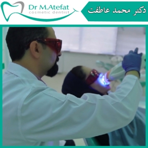 مزایای بلیچینگ دندان ها در مطب دندانپزشکی