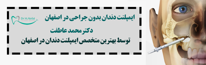 ایمپلنت بدون جراحی در اصفهان