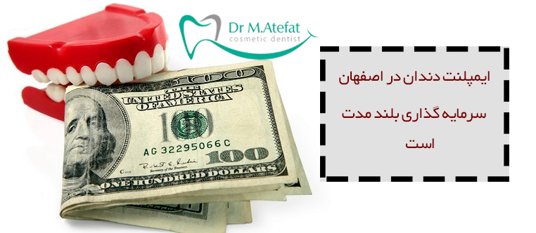 قیمت ایمپلنت دندان در اصفهان 