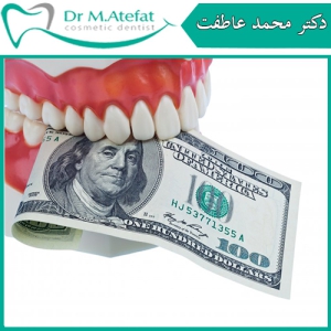 قیمت ایمپلنت دندان در اصفهان