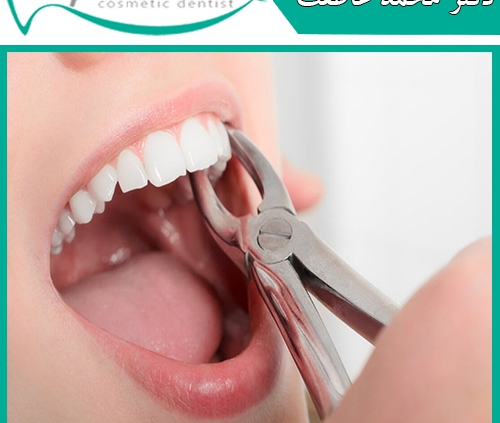 پرکردن دندان یا کشیدن دندان