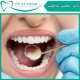 حقایقی درباره سلامت دندان و دهان