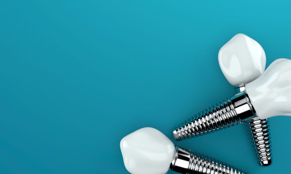 چهار تصورغلط درباره ایمپلنت های دندانی