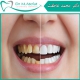 درمان های زیبایی دندان چقدر طول می کشند؟